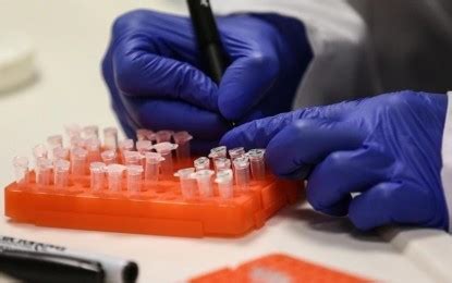 vaxcertsupport@doh.gov.ph|DOH seeks 2K vaccine doses vs. mpox .